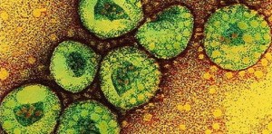 Coronavirus: 2 cas confirmés en Algérie