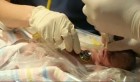 Hongrie : un bébé naît d’une mère en état de mort cérébrale