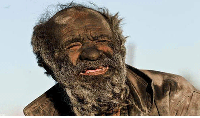 A 80 ans il n’a pas pris de bain depuis 60 ans !