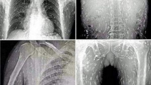 Les photos qui risquent de vous faire dégoûter du sushis