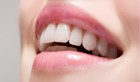 Les 10 aliments à consommer pour avoir des dents blanches