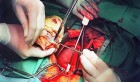 USA : Le premier patient greffé de cœur de porc est mort