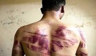 Bab Souika: Il déclare avoir été torturé et maltraité par la police