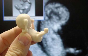Bizerte: Découverte de cinq fœtus dans un pot…