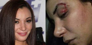 VIDEO: Loubna Abidar, l’actrice de ‘Much Loved’ sauvagement agressée au Maroc