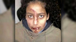 Allemagne : Agression d’un tunisien et sa fille de 13 ans par des extrémistes nazi