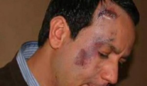 Alaa Chebbi, Faycel Riahi et Ahmed Mejri attaqués par des jeunes!