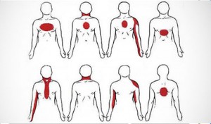 Santé : Voici les signes avant coureur d’une crise cardiaque