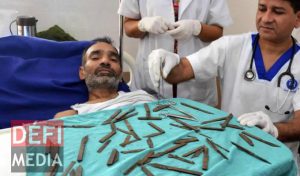 Inde: Les médecins découvrent 40 couteaux dans son estomac (VIDEO)