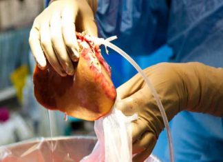 Trafic d’organes humains: Le Conseil de l’Europe présente à Tunis son arsenal pénal