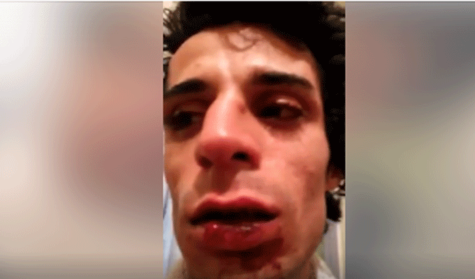 Agression homophobe : La victime porte plainte