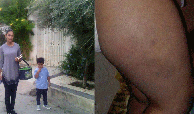 Ben Arous : Un enfant libyen de 4 ans maltraité dans un jardin d’enfants