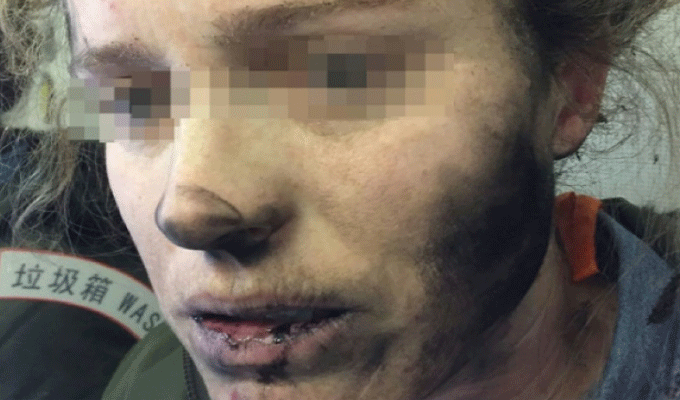 Vol Pékin – Melbourne : Ses écouteurs explosent en plein vol, photos