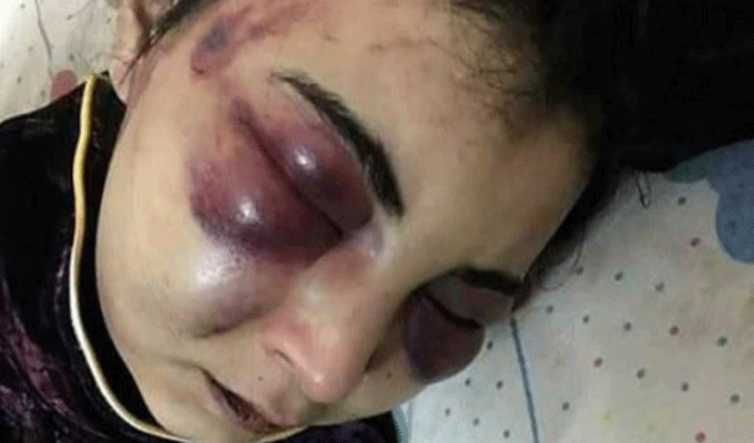 Un homme torture son épouse durant 3 jours suite à la création d’un compte Facebook