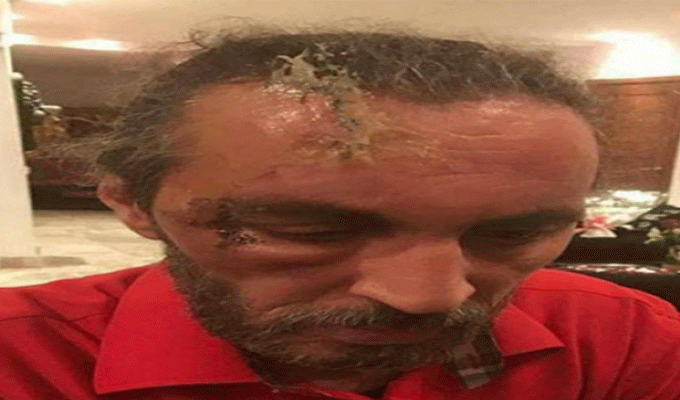 Le réalisateur de ‘Fausse Couche’ victime d’une agression physique