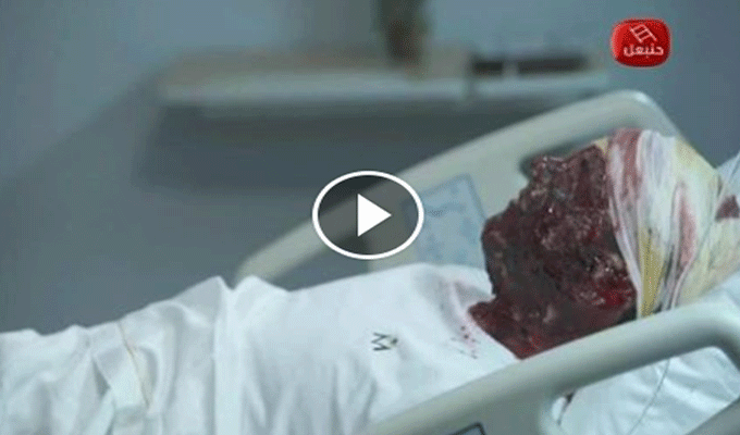 Vidéo : Découvrez toutes les victimes de la caméra cachée, El Clinique