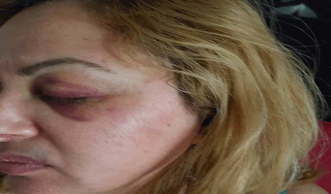 Lac 2 : Une professeure sauvagement agressée par les forces de l’ordre