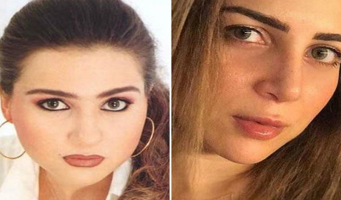 Découvrez May Ezzedine après sa rhinoplastie, en photo