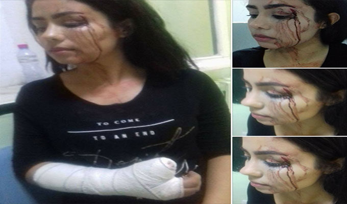 Ma Lam Yokal : Syrine Cherni donne des détails sur son agression par un policier en civil