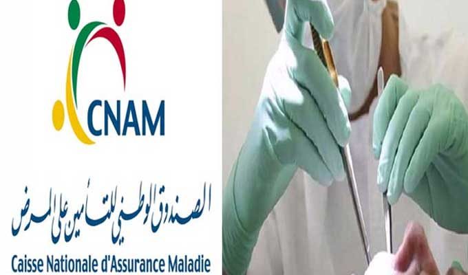 Tunisie: Les prothèses dentaires sont prises en charge par la CNAM à partir du mois d’avril 2019