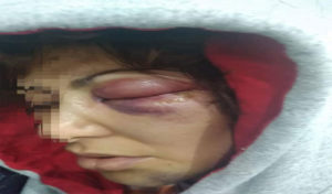 Tunisie : Une avocate violemment agressée par quatre braqueurs