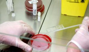 COVID-19 : Les tests de diagnostic rapide antigéniques doivent être utilisés dans un laboratoire de biologie