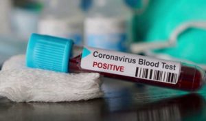 Coronavirus : La Belgique enregistre un premier décès