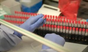 Metlaoui-coronavirus: 119 personnes testées négatives au quartier El-Kayna