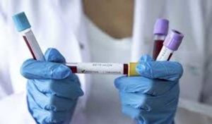 Tunisie : Béja enregistre cinq nouvelles contaminations au coronavirus