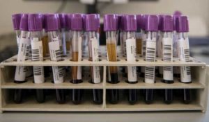 Esma Shiri: Résultats rassurants en matière de lutte contre le coronavirus