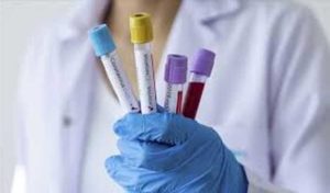 Tunisie : Des cas positifs au coronavirus détectés parmi des voyageurs ayant présenté des tests PCR négatifs