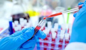 Tunisie: Liste actualisée des laboratoires privés habilités à effectuer le test de dépistage du Coronavirus