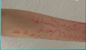 Après avoir écrit sur le bras d’un élève, l’enseignante est menacée