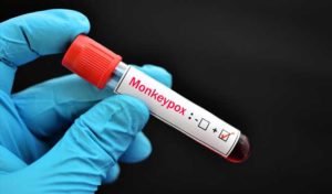 Egypte : Un cas contact au Monkeypox