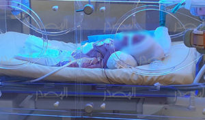 Tunisie : un succès médical inédit en Afrique et en Europe