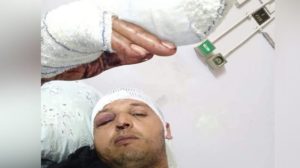 Chauffeur de taxi à Sousse victime d’un braquage: partie de ses doigts amputée