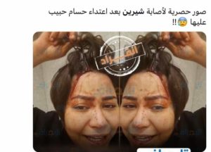 Sherine Abdel Wahab accuse Hossam Habib de violences : le rapport médical dévoilé
