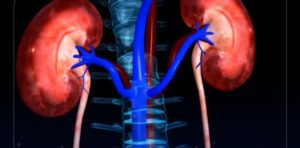 100 % de succès pour les greffes de rein à Sahloul : un modèle d’excellence