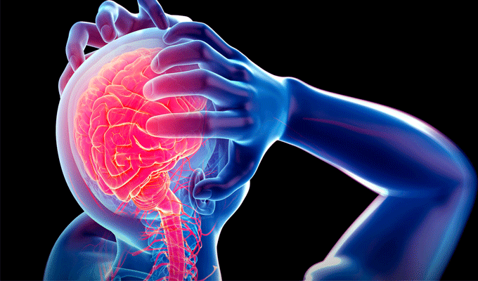 Accidents vasculaires cérébraux : 3000 nouveaux cas annuellement en Tunisie, un chiffre alarment