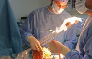 Une première en Tunisie : 3 opérations endoscopiques réussies sur des nourrissons pour corriger une malformation