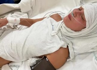 Bella Hadid hospitalisée : son combat bouleversant contre la maladie de Lyme