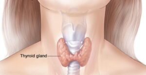 FB_IMG_1765746993883 Gafsa : lancement de la première campagne nationale de dépistage des maladies de la thyroïde